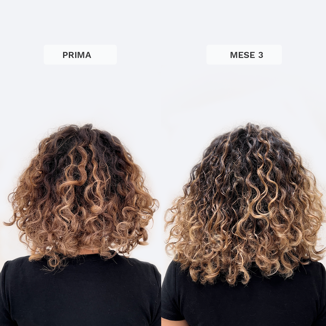 Vitamine Gommose per la Crescita dei Capelli