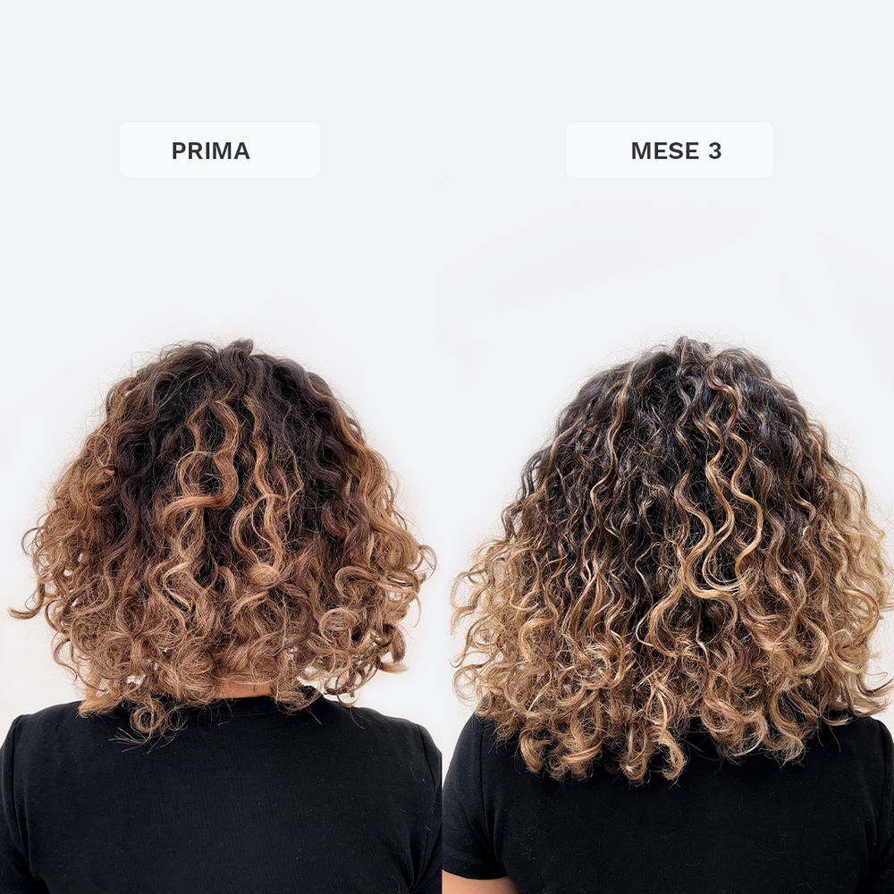 Vitamine Gommose per la Crescita dei Capelli