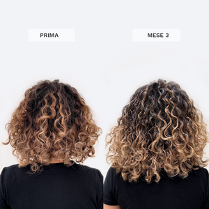 Vitamine Gommose per la Crescita dei Capelli