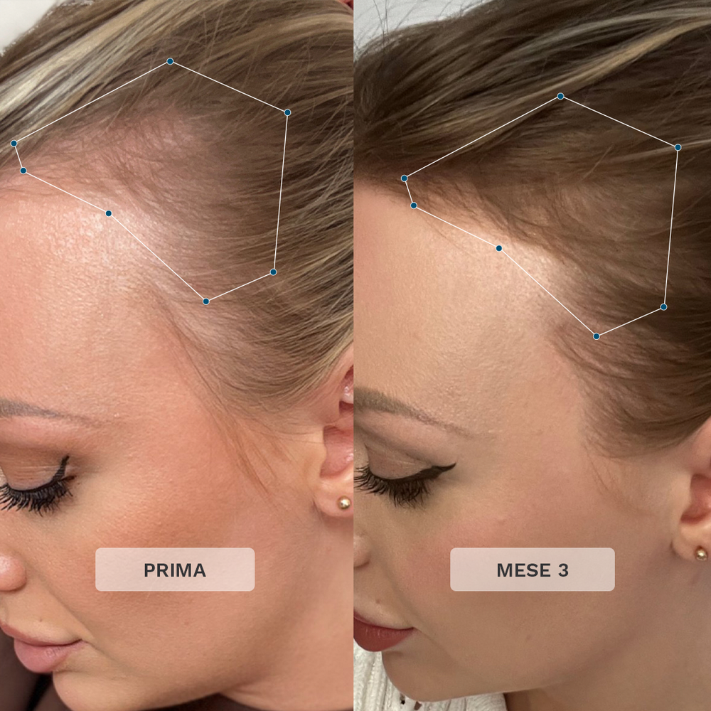 Formula Premium Advanced+ per i Capelli