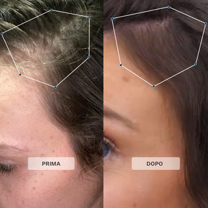 Siero Multi Attivo per la Crescita dei Capelli